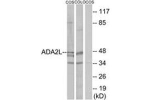 Western Blotting (WB) image for anti-Transcriptional Adaptor 2A (TADA2A) (AA 206-255) antibody (ABIN2889346) (TADA2L antibody  (AA 206-255))