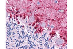 Immunohistochemistry (IHC) image for anti-Kruppel-Like Factor 2 (Lung) (KLF2) (Middle Region) antibody (ABIN2777573) (KLF2 antibody  (Middle Region))