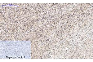 Immunohistochemical analysis of paraffin-embedded human uterus tissue. (MMP2 antibody  (AA 580-660))