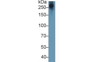 Detection of AGC in Human Lymphocyte lysate using Monoclonal Antibody to Aggrecan (AGC) (Aggrecan antibody  (AA 2163-2316))