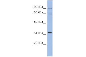 WB Suggested Anti-TBC1D14 Antibody Titration: 0.