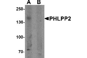 Western blot analysis of PHLPP2 in SW480 cell lysate with PHLPP2 antibody at 1 µg/mL in (A) the presence and (B) the absence of blocking peptide. (PHLPP2 antibody  (C-Term))