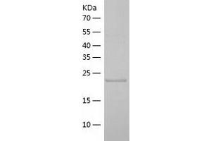 Western Blotting (WB) image for Zinc Finger, AN1-Type Domain 5 (ZFAND5) (AA 1-213) protein (His tag) (ABIN7284672) (ZFAND5 Protein (AA 1-213) (His tag))