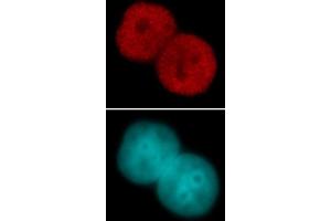 Histone H3 acetyl Lys23 pAb tested by immunofluorescence. (Histone 3 antibody  (H3K23ac))