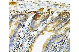 Immunohistochemistry (Paraffin-embedded Sections) (IHC (p)) image for anti-Ras-Related GTP Binding C (RRAGC) antibody (ABIN7263499)