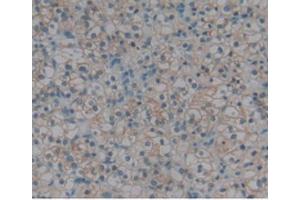 IHC-P analysis of Human Kidney, with DAB staining. (Renin antibody  (AA 67-179))