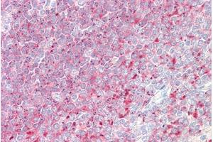 ABIN334514 (3. (TPD52 antibody  (C-Term))