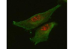IF analysis of RETREG1 using anti-RETREG1 antibody (ABIN7599962) and anti-Tubulin Alpha antibody (ABIN7600339).