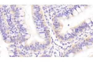 Detection of GOLPH2 in Human Small intestine Tissue using Polyclonal Antibody to Golgi Phosphoprotein 2 (GOLPH2) (GOLM1 antibody  (AA 119-223))