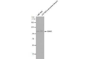 WB Image DAG1 antibody detects DAG1 protein by western blot analysis. (Dystroglycan antibody)