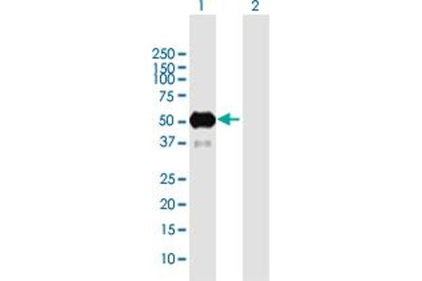 Oncostatin M Receptor antibody  (AA 1-342)