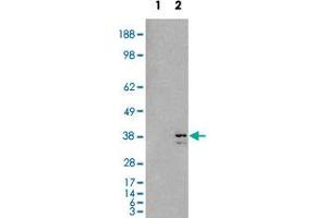 HEK293 overexpressing SIRT4 and probed with SIRT4 polyclonal antibody  (mock transfection in first lane), tested by Origene. (SIRT4 antibody  (C-Term))