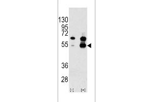 Western blot analysis of VEGF1 Antibody polyclonal antibody using 293 cell lysates (2 ug/lane) either nontransfected (Lane 1) or transiently transfected with the VEGF1 gene (Lane 2). (VEGF1 antibody  (N-Term))