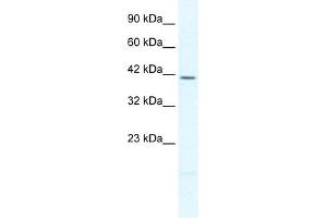 PITX2 antibody  (N-Term)