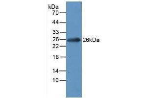 Figure. (MYL1 antibody  (AA 3-142))