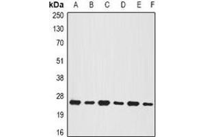 Western blot analysis of BNIP1 expression in MCF7 (A), Jurkat (B), mouse testis (C), mouse pancreas (D), rat brain (E), rat liver (F) whole cell lysates. (BNIP1 antibody)