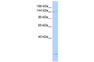 SMC4 antibody used at 1 ug/ml to detect target protein. (SMC4 antibody  (N-Term))