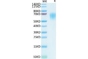 SARS-COV-2 Spike S1 NTD on Tris-Bis PAGE under reduced condition. (SARS-CoV-2 Spike S1 Protein (His-DYKDDDDK Tag))