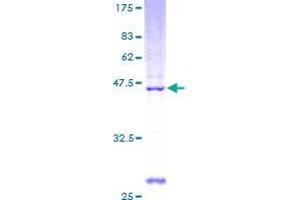 Image no. 1 for Prepronociceptin (PNOC) (AA 1-176) protein (GST tag) (ABIN1315581) (PNOC Protein (AA 1-176) (GST tag))