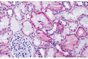Human Kidney: Formalin-Fixed, Paraffin-Embedded (FFPE) (CD147 antibody  (N-Term))