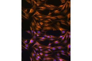 Immunofluorescence analysis of C6 cells using SO Rabbit pAb (ABIN6129624, ABIN6148259, ABIN6148260 and ABIN6221917) at dilution of 1:100. (SOAT1 antibody  (AA 1-130))