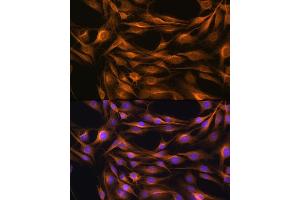 Immunofluorescence analysis of C6 cells using SO Rabbit pAb (ABIN6129624, ABIN6148259, ABIN6148260 and ABIN6221917) at dilution of 1:100. (SOAT1 antibody  (AA 1-130))