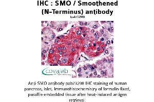Image no. 1 for anti-Smoothened Homolog (Drosophila) (SMO) (Extracellular Domain), (N-Term) antibody (ABIN1739462)