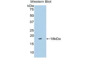 Western Blotting (WB) image for anti-Leucine Rich Repeat (In FLII) Interacting Protein 1 (LRRFIP1) (AA 128-250) antibody (ABIN1859714) (LRRFIP1 antibody  (AA 128-250))