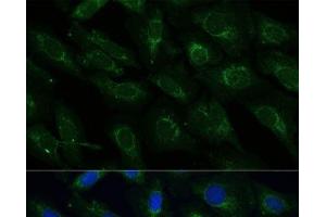 Immunofluorescence analysis of U-2 OS cells using NDUFB4 Polyclonal Antibody at dilution of 1:100 (40x lens). (NDUFB4 antibody)