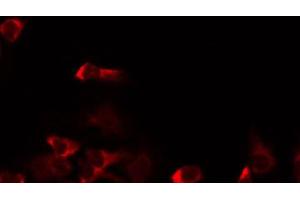 ABIN6267002 staining HeLa by IF/ICC. (MRRF antibody  (Internal Region))