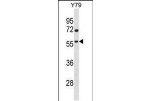Western blot analysis in Y79 cell line lysates (35ug/lane). (TAF1A antibody  (N-Term))