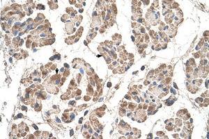 Image no. 1 for anti-Motile Sperm Domain Containing 3 (MOSPD3) (C-Term) antibody (ABIN205067) (MOSPD3 antibody  (C-Term))