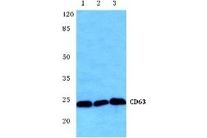 Western blot (WB) analysis of CD63 antibody at 1/500 dilution (CD63 antibody)