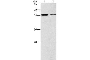 Western Blot analysis of Jurkat and 293T cell using ARHGAP15 Polyclonal Antibody at dilution of 1:500 (ARHGAP15 antibody)