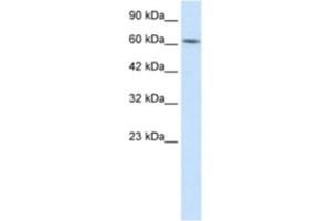 Western Blotting (WB) image for anti-Kelch-Like 28 (KLHL28) antibody (ABIN2460991) (KLHL28 antibody)
