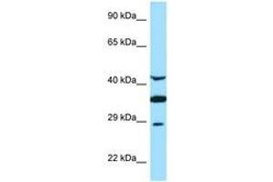 Image no. 1 for anti-Torsin Family 1, Member A (Torsin A) (TOR1A) (AA 201-250) antibody (ABIN6748405) (TOR1A antibody  (AA 201-250))