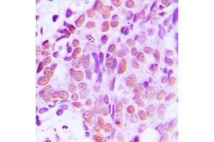 Immunohistochemistry (IHC) image for anti-X-Ray Repair Complementing Defective Repair in Chinese Hamster Cells 1 (XRCC1) (C-Term) antibody (ABIN7297284)