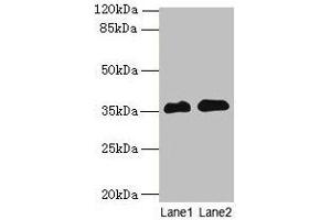 Western blot All lanes: RFPL3 antibody at 8 μg/mL Lane 1: Human placenta tissue Lane 2: HL60 whole cell lysate Secondary Goat polyclonal to rabbit IgG at 1/10000 dilution Predicted band size: 36, 33 kDa Observed band size: 36 kDa (RFPL3 antibody  (AA 8-288))