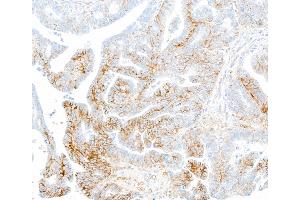 Immunohistochemistry (IHC) image for anti-Syndecan 1 (SDC1) (AA 23-251) antibody (ABIN7795740)