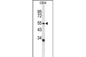 Western blot analysis of ACCN2 Antibody (C-term) (ABIN653218 and ABIN2842754) in CEM cell line lysates (35 μg/lane). (ASIC1 antibody  (C-Term))