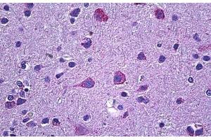 ABIN571064 (3. (Prokineticin Receptor 2 antibody  (Internal Region))