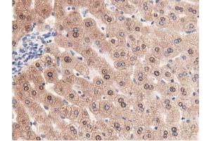 Immunohistochemical staining of paraffin-embedded Human liver tissue using anti-PRPSAP2 mouse monoclonal antibody.