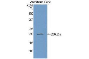Western Blotting (WB) image for anti-Matrix Gla Protein (MGP) (AA 20-104) antibody (ABIN1174663) (MGP antibody  (AA 20-104))