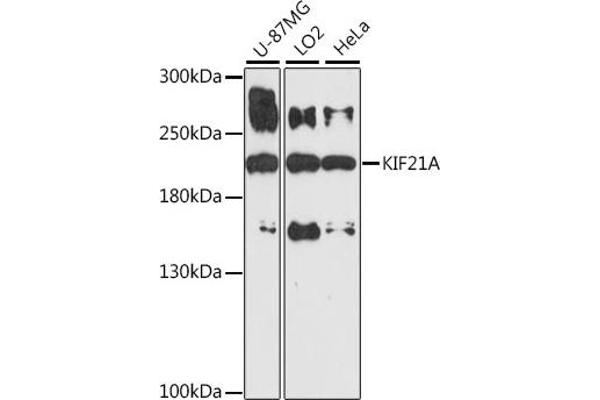 KIF21A anticorps  (AA 1070-1270)