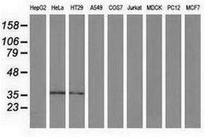 Image no. 2 for anti-Annexin A3 (ANXA3) antibody (ABIN1496644) (Annexin A3 antibody)