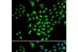 Immunofluorescence (IF) image for anti-Runt-Related Transcription Factor 1 (RUNX1) antibody (ABIN7260099)