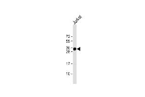 Anti-TMX1 Antibody (C-term) at 1:1000 dilution + Jurkat whole cell lysate Lysates/proteins at 20 μg per lane. (TMX1 antibody  (C-Term))