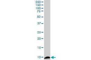 S100A4 monoclonal antibody (M01), clone 1F12-1G7. (s100a4 antibody  (AA 1-101))