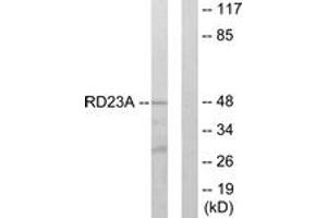 Western blot analysis of extracts from LOVO cells, using RAD23A Antibody. (RAD23A antibody  (AA 91-140))