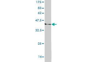 Western Blot detection against Immunogen (37. (RECQL2 antibody  (AA 1322-1432))